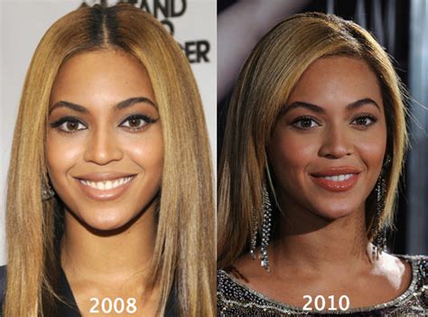 beyonce before and after plastic surgery